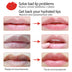 Vitamin C Moisturizing Lip Mask Patches